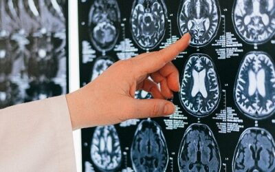 Tech News : Musk’s Brain Chips Ready For Humans.